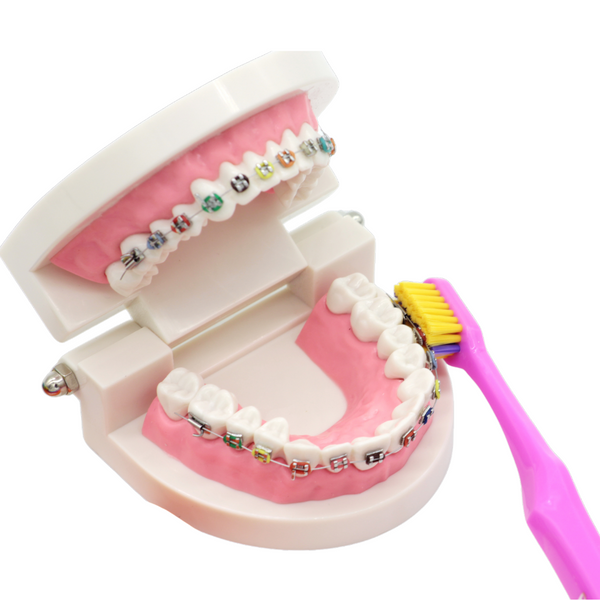 3980 Super Soft Ortho | Szczoteczka do aparat&oacute;w ortodontycznych &ndash; ż&oacute;łta